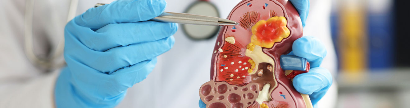 Nephrology - Balaji Healthcare